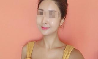 미앤미 울산점 물톡스 수분팡팡