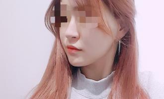 코.이마.애교필러♥턱보톡스